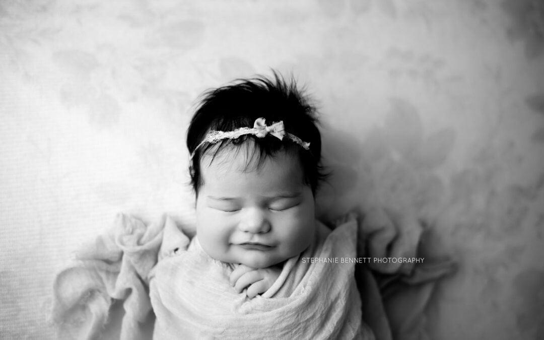 What to Do If Your Baby Has Jaundice