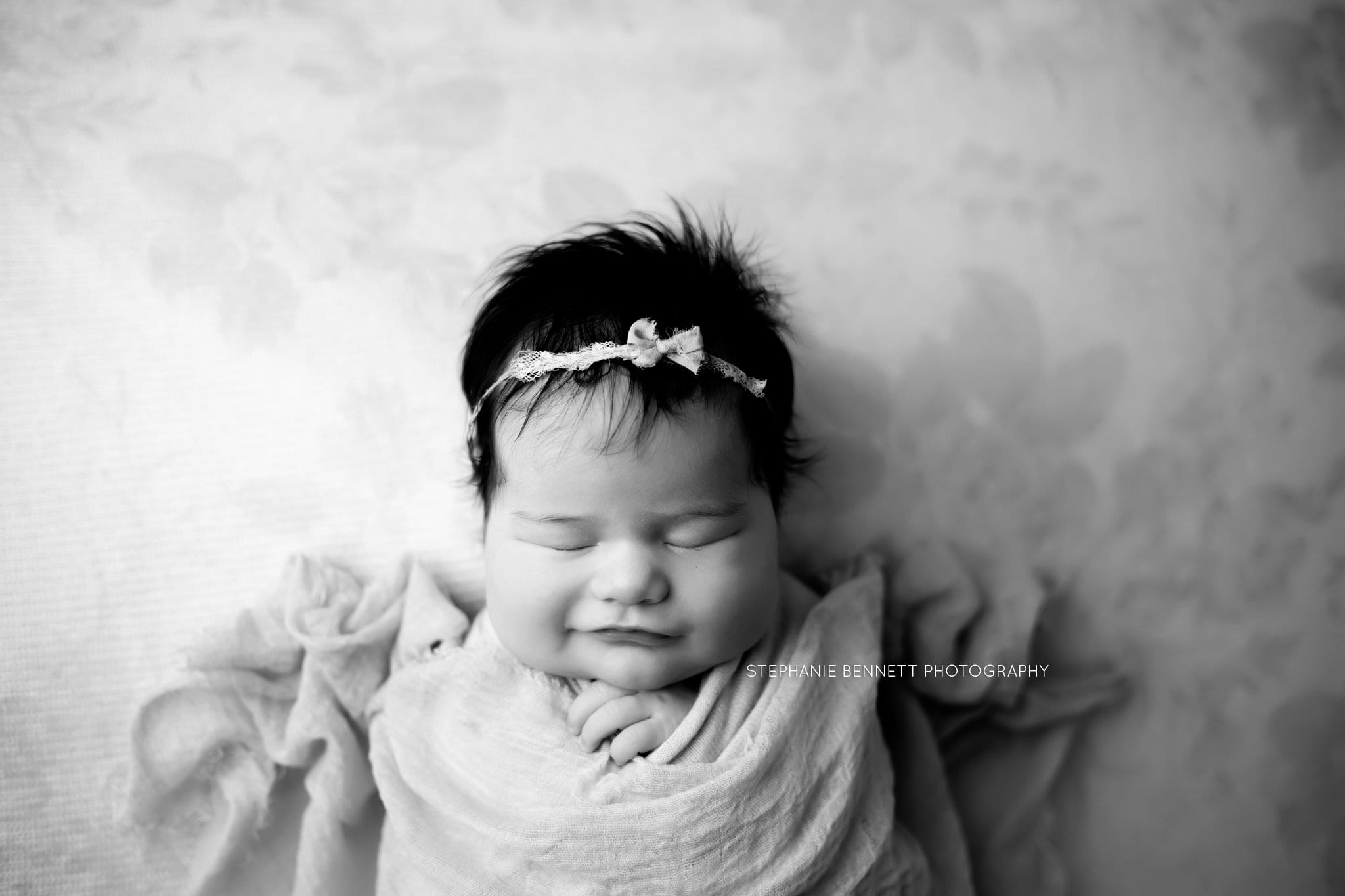 What to Do If Your Baby Has Jaundice